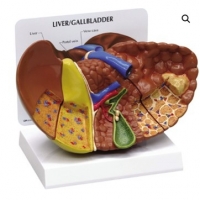 A7521 Модель патологий печени